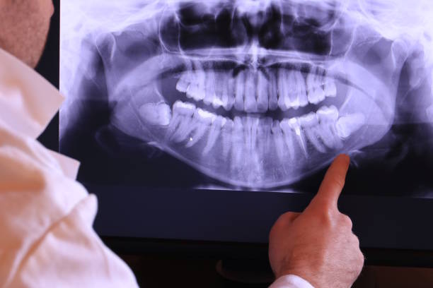 Best Tooth Pain Emergency Relief  in Roaming Shores, OH