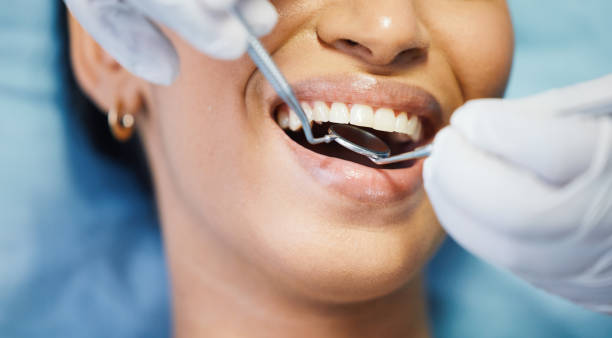 Best Urgent Tooth Repair  in Roaming Shores, OH